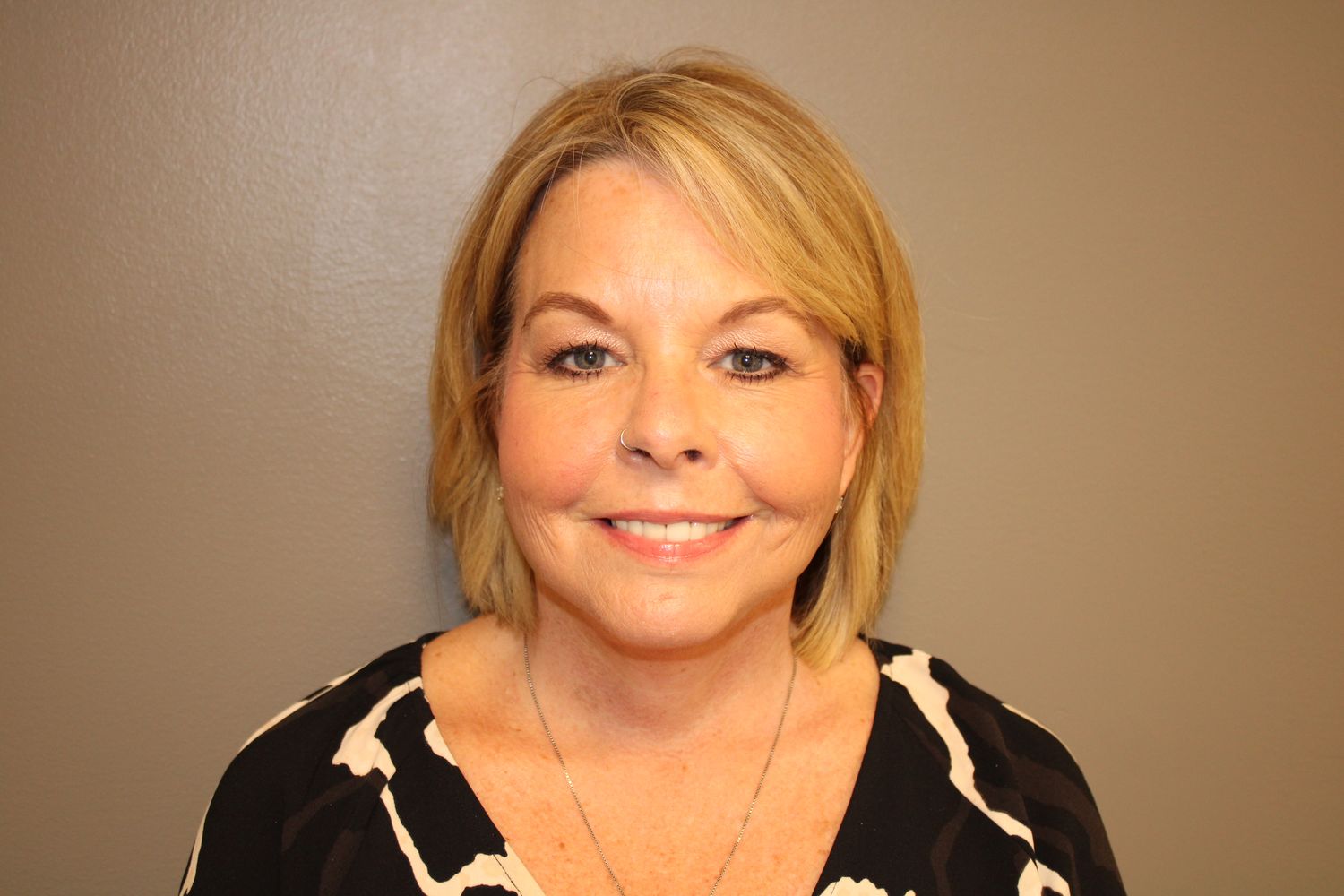 Facelift Before & After